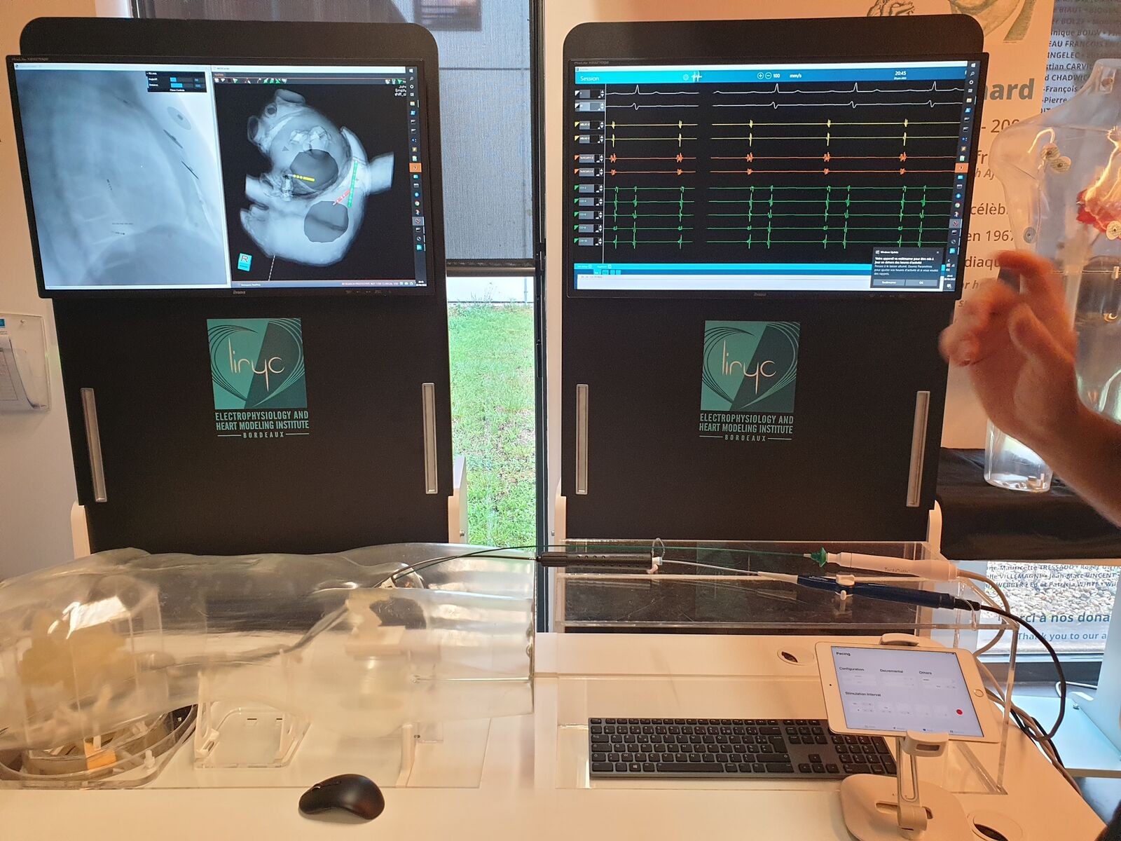 Here, you can learn how to control catheters in the heart chambers.